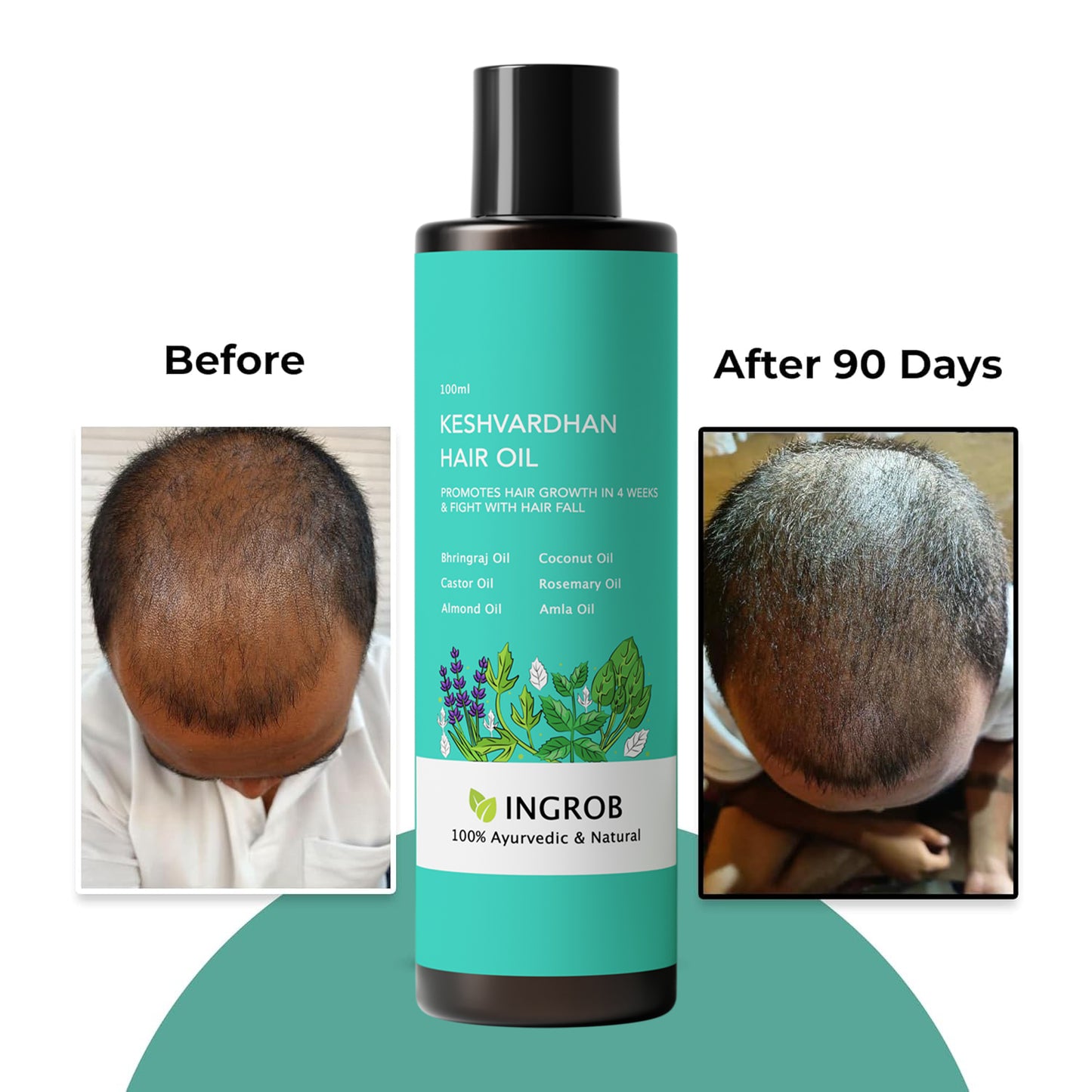 INGROB Keshvardhan Hair Oil For Men & Women | Promotes Hair Growth & Reduces Hair Fall | With Rosemary, Castor, Amla, Coconut and Bhringraj Oil | Mineral Oil Free | 100 ml